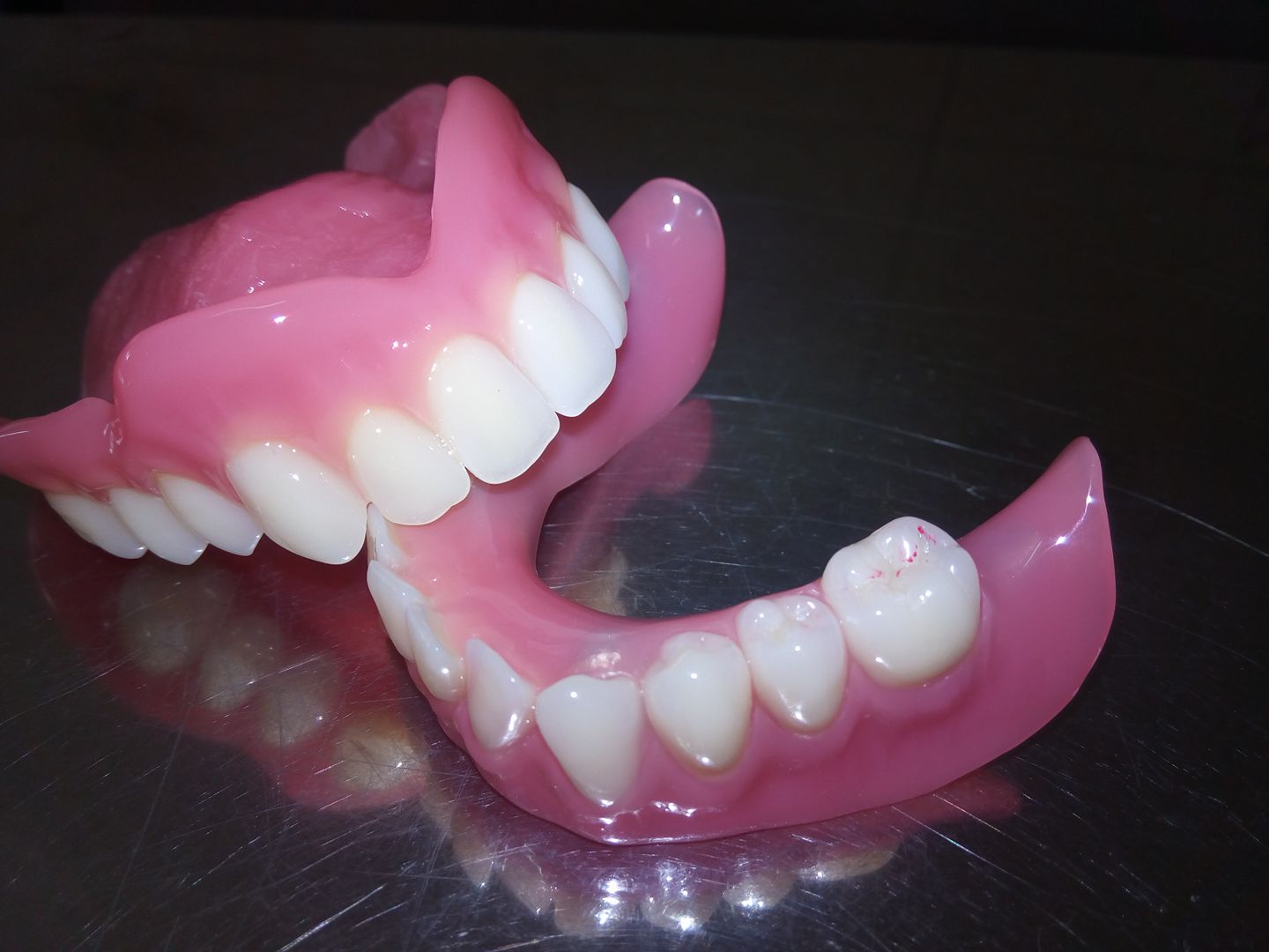 esempio di dentiera completa
