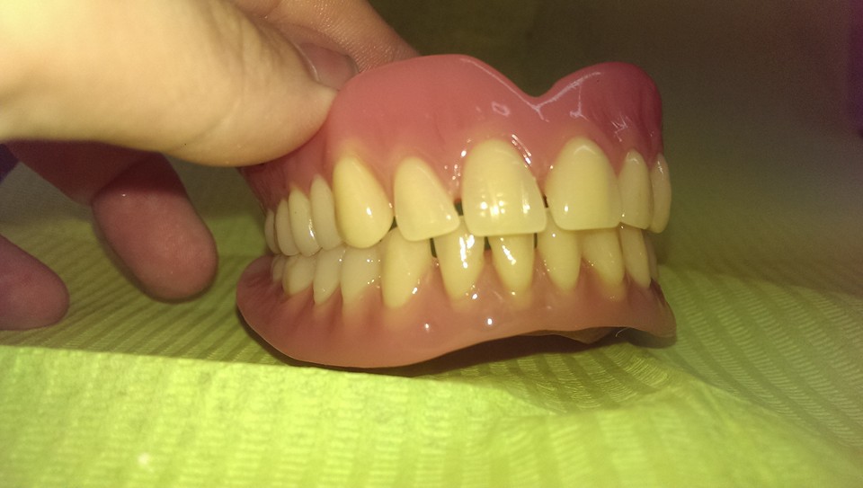 esempio di dentiera completa