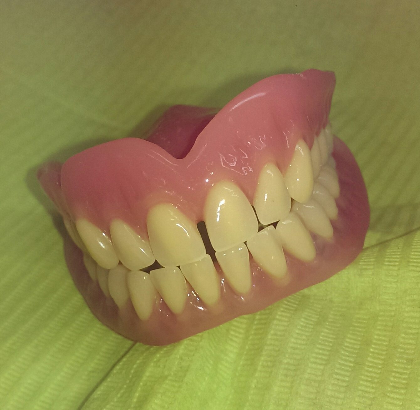 esempio di dentiera completa