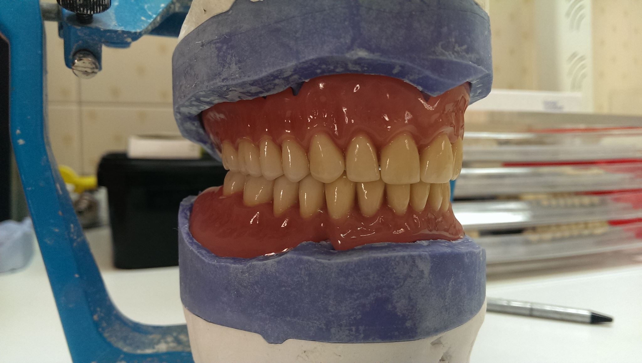 esempio di dentiera completa
