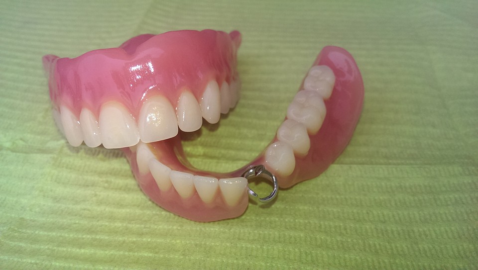 esempio di dentiera completa