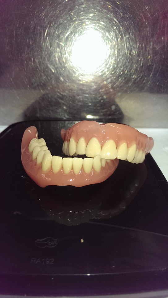 esempio di dentiera completa