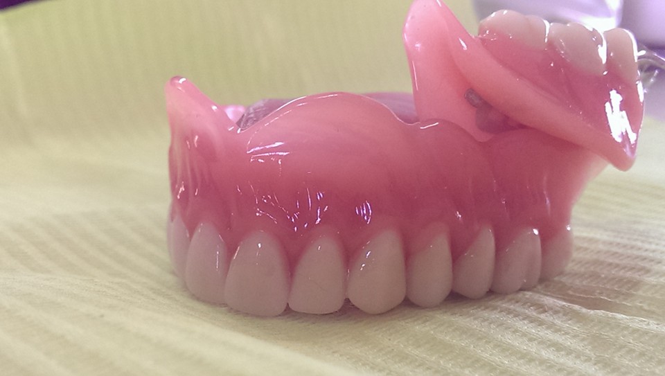 esempio di dentiera completa